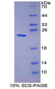 Figure 1. SDS-PAGE