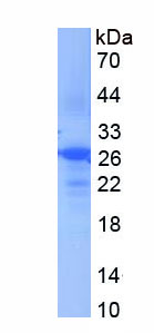 Figure 1. SDS-PAGE
