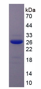 Figure 1. SDS-PAGE