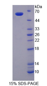 Figure 1. SDS-PAGE