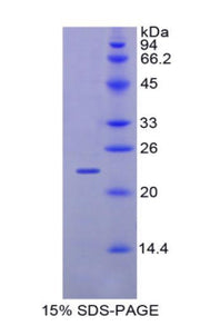 Figure 1. SDS-PAGE