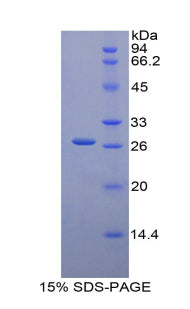 Figure 1. SDS-PAGE