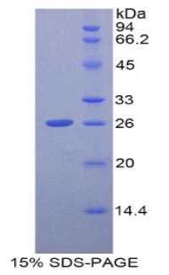 Figure 1. SDS-PAGE