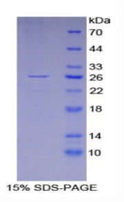 Figure 1. SDS-PAGE