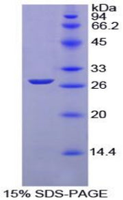Figure 1. SDS-PAGE