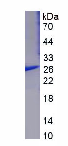 Figure 1. SDS-PAGE