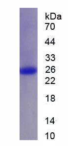 Figure 1. SDS-PAGE
