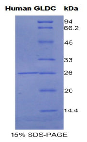 Figure 1. SDS-PAGE