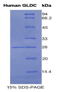 Figure 1. SDS-PAGE