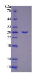Figure 3. SDS-PAGE