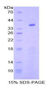Figure 1. SDS-PAGE
