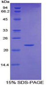 Figure 1. SDS-PAGE