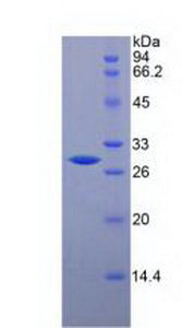 Figure 2. SDS-PAGE