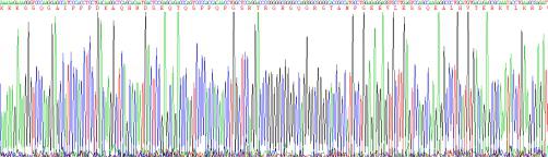 Recombinant Mouse Gremlin 1 (GREM1)