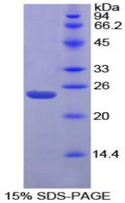 Figure 1. SDS-PAGE