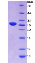 Figure 2. SDS-PAGE