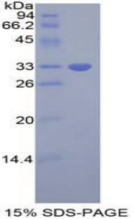 Figure 1. SDS-PAGE