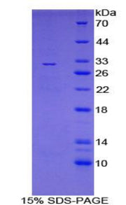 Figure 1. SDS-PAGE