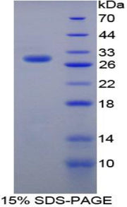 Figure 1. SDS-PAGE