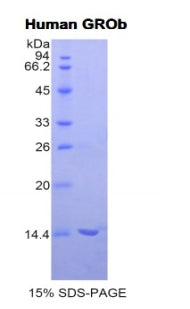 Figure 1. SDS-PAGE