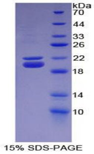 Figure 1. SDS-PAGE