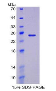 Figure 1. SDS-PAGE
