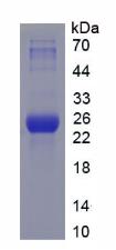 Figure 2. SDS-PAGE