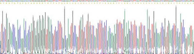 Recombinant Human Heat Shock Protein 90kDa Alpha A1 (HSP90aA1)