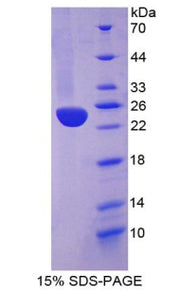 Figure 1. SDS-PAGE
