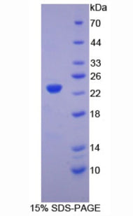 Figure 1. SDS-PAGE