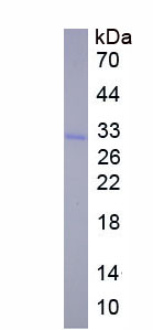 Figure 1. SDS-PAGE