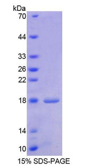 Figure 1. SDS-PAGE