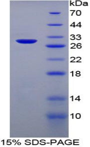 Figure 1. SDS-PAGE