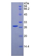 Figure 2. SDS-PAGE