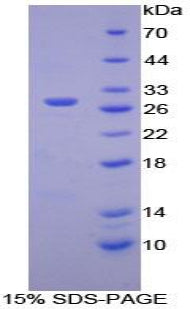 Figure 1. SDS-PAGE
