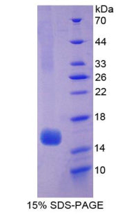 Figure 1. SDS-PAGE
