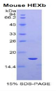 Figure 1. SDS-PAGE