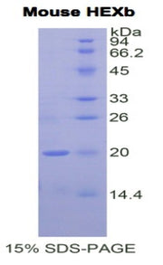 Figure 1. SDS-PAGE