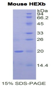 Figure 1. SDS-PAGE