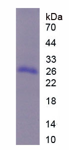 Figure 1. SDS-PAGE