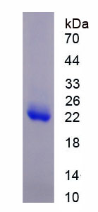 Figure 1. SDS-PAGE