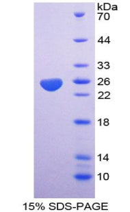 Figure 1. SDS-PAGE