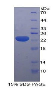 Figure 1. SDS-PAGE