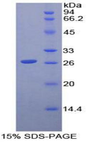 Figure 1. SDS-PAGE