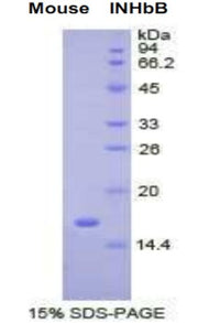 Figure 1. SDS-PAGE