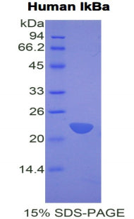 Figure 1. SDS-PAGE