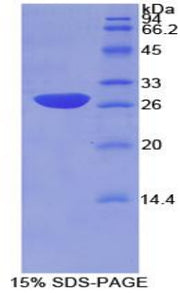 Figure 1. SDS-PAGE