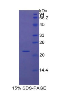 Figure 1. SDS-PAGE