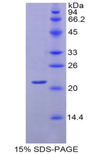 Figure 1. SDS-PAGE