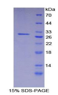 Figure 1. SDS-PAGE